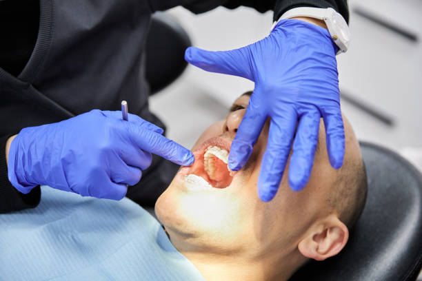 Best Emergency Dental Care for Broken or Chipped Teeth in De Graff, OH